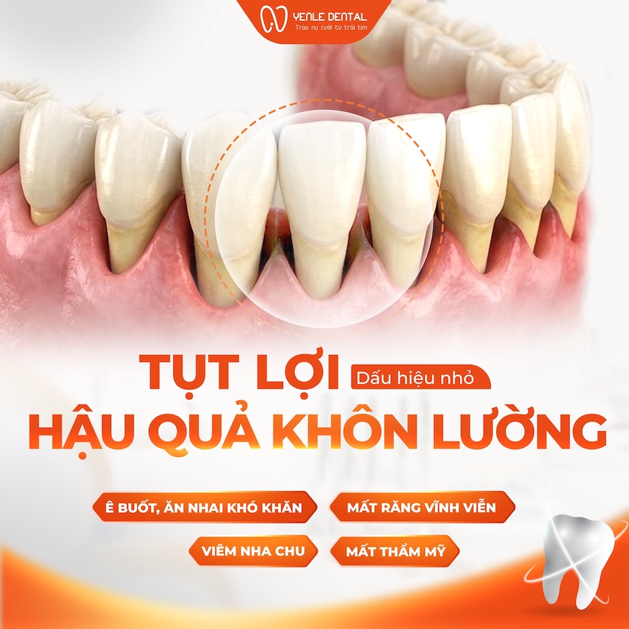 tụt lợi 